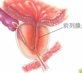 前列腺为什么会出现疼痛感?