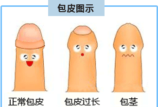 包皮过长会给男性造成什么危害?