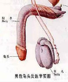 什么原因导致包皮龟头炎症屡屡来袭?