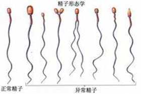 怎么预防精子畸形?